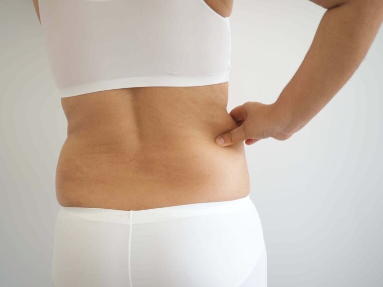 How to deal with excess skin after losing weight After losing weight, many people are left with excess skin. Here's how you can fix that problem.